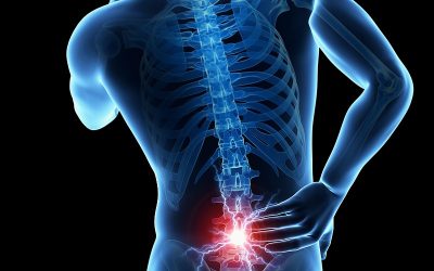 La ayuda del cannabis en el tratamiento de la hernia lumbar