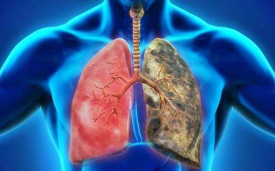CBD para la Enfermedad Pulmonar Obstructiva Crónica (EPOC)