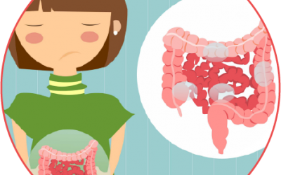 Enfermedad intestinal inflamatoria crónica: ¿Pueden ser de ayuda los cannabinoides?