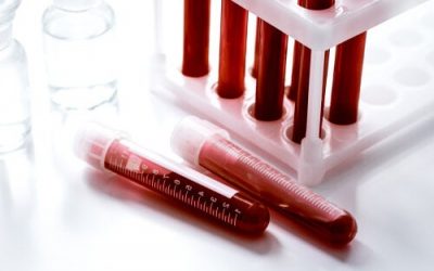 CBD para la Porfiria: hechos, beneficios y uso