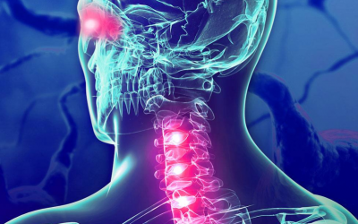 Tratamiento de la Neuromielitis Óptica (NMO) con cannabis