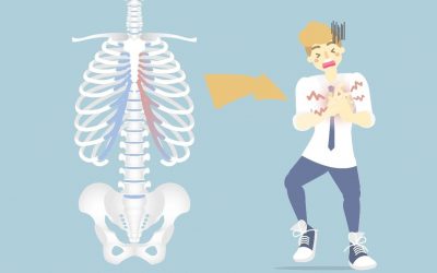 Costocondritis: tratar el síndrome de Tietze con el cannabis