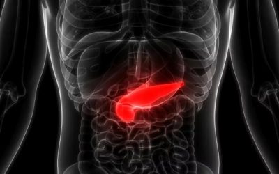 Cannabinoides para aliviar la pancreatitis aguda