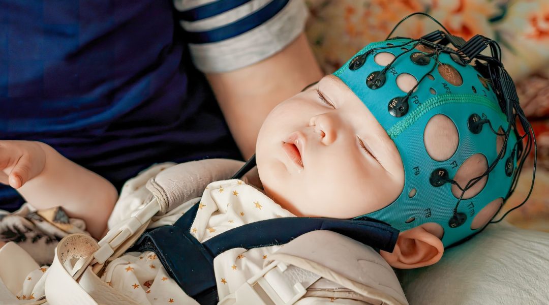 Síndrome de West: un estudio argentino mostró buenos resultados del cannabidiol para esta rara epilepsia